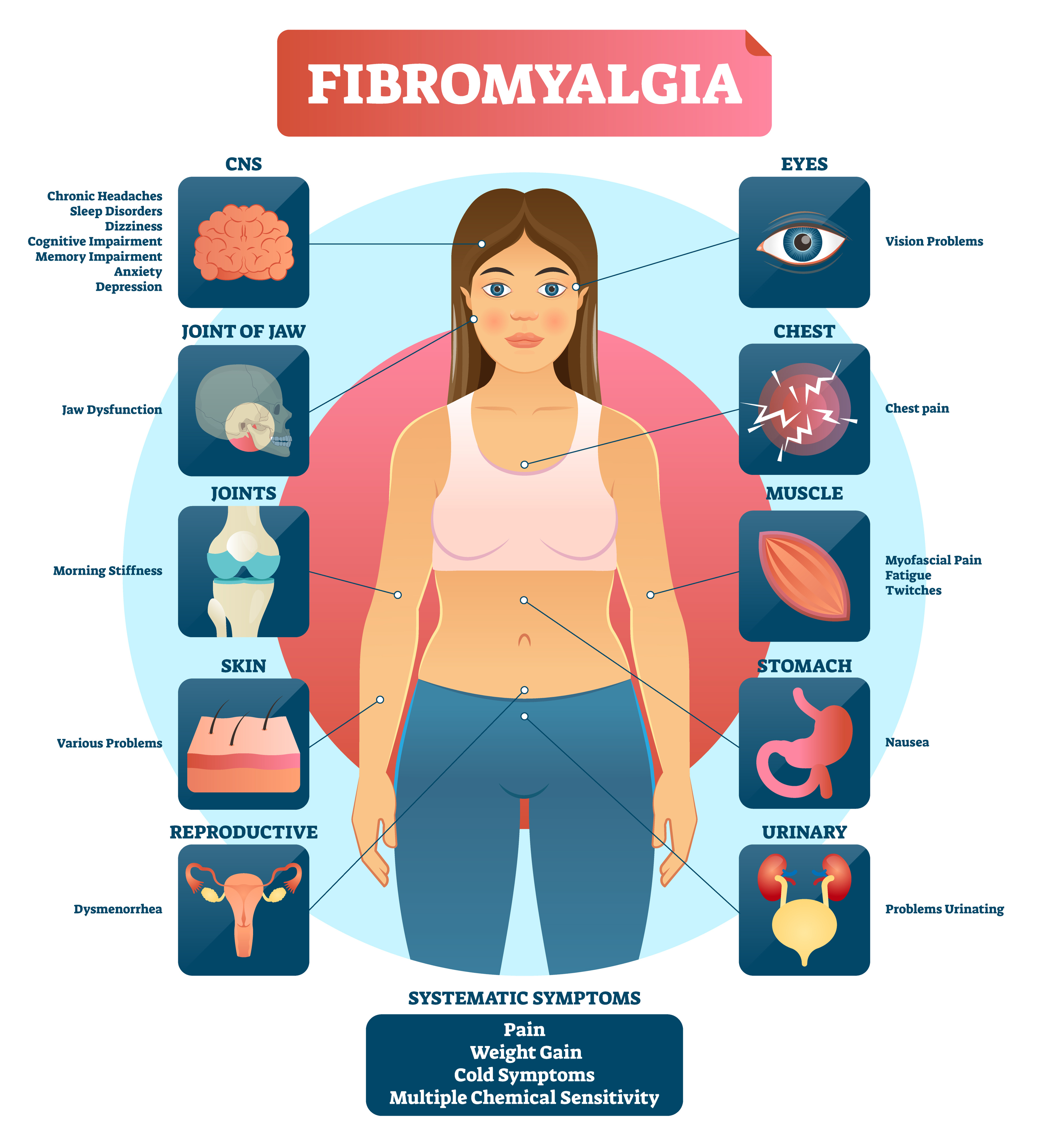Fibromyalgia Symptoms